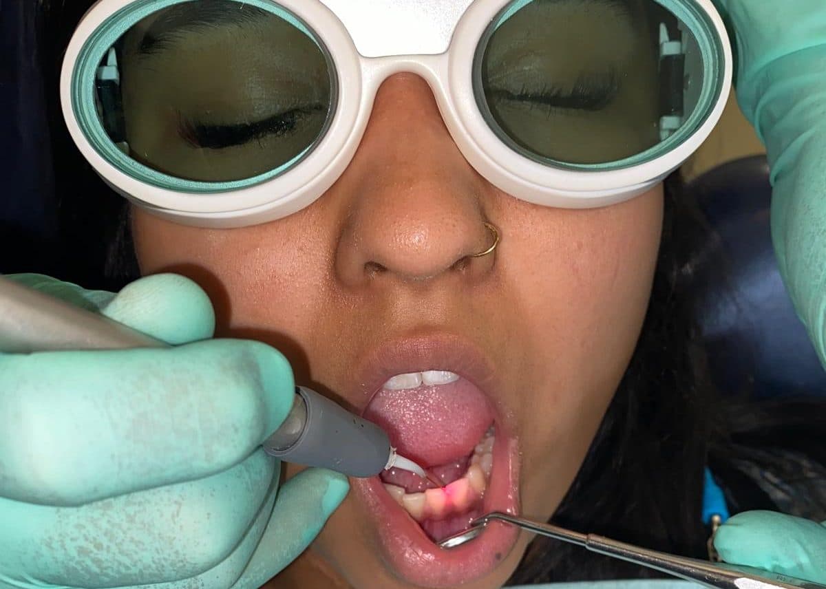 Patientin erhält Parodontose Laser Therapy zur Behandlung von Zahnfleischerkrankungen mit Schutzbrille.